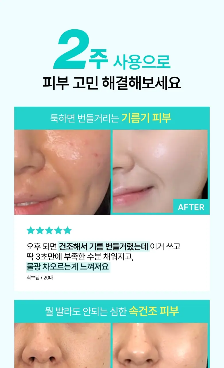 [화해1위] 아누아 피디알엔 히알루론산 캡슐 100 세럼 1ml*10ea 상세페이지 8